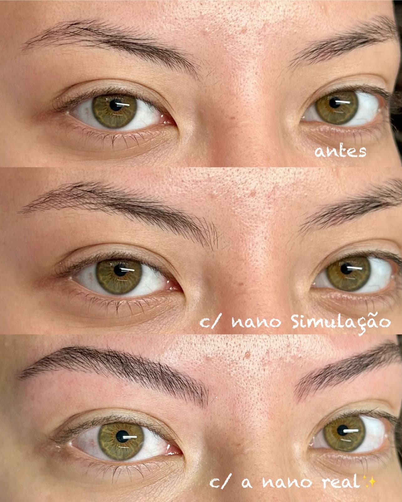 Comparativo: antes, com nano simulação e com nano pigmentação real